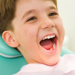 Photo of youngster with his mouth wide open during checkup at the dentist’s